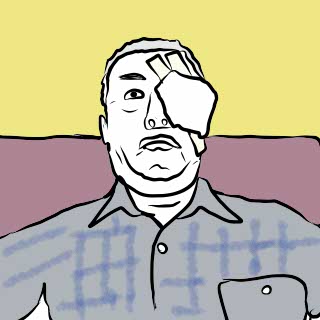 白内障手術しました。